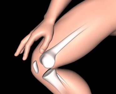 ACL Injury Treatment in Surat at Renison Knee & Shoulder Clinic